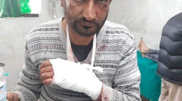 40-year old man injured in Sopore bear attack