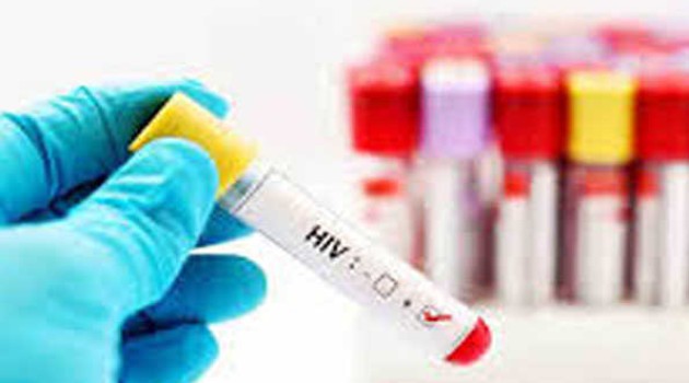 Over 600 people tested HIV positive in Sindh province of Pakistan