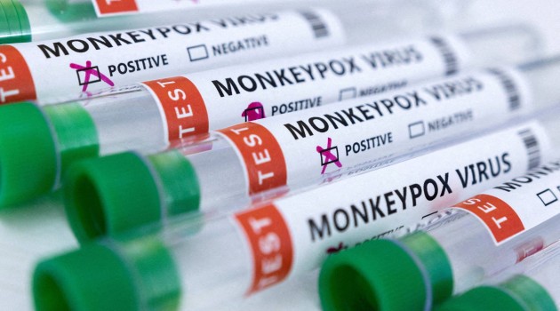 Spain reports first monkeypox death